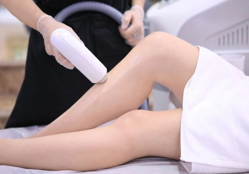 Triệt lông Diode Laser